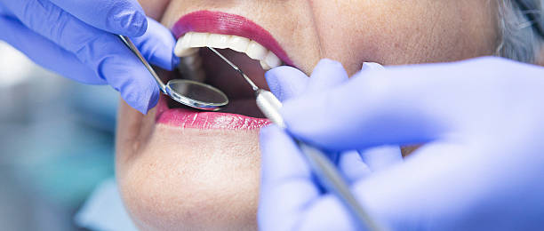 Best Chipped Tooth Repair Near Me  in Hamlin, WV